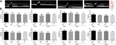 Compound Danshen dripping pills prevent early diabetic retinopathy: roles of vascular protection and neuroprotection